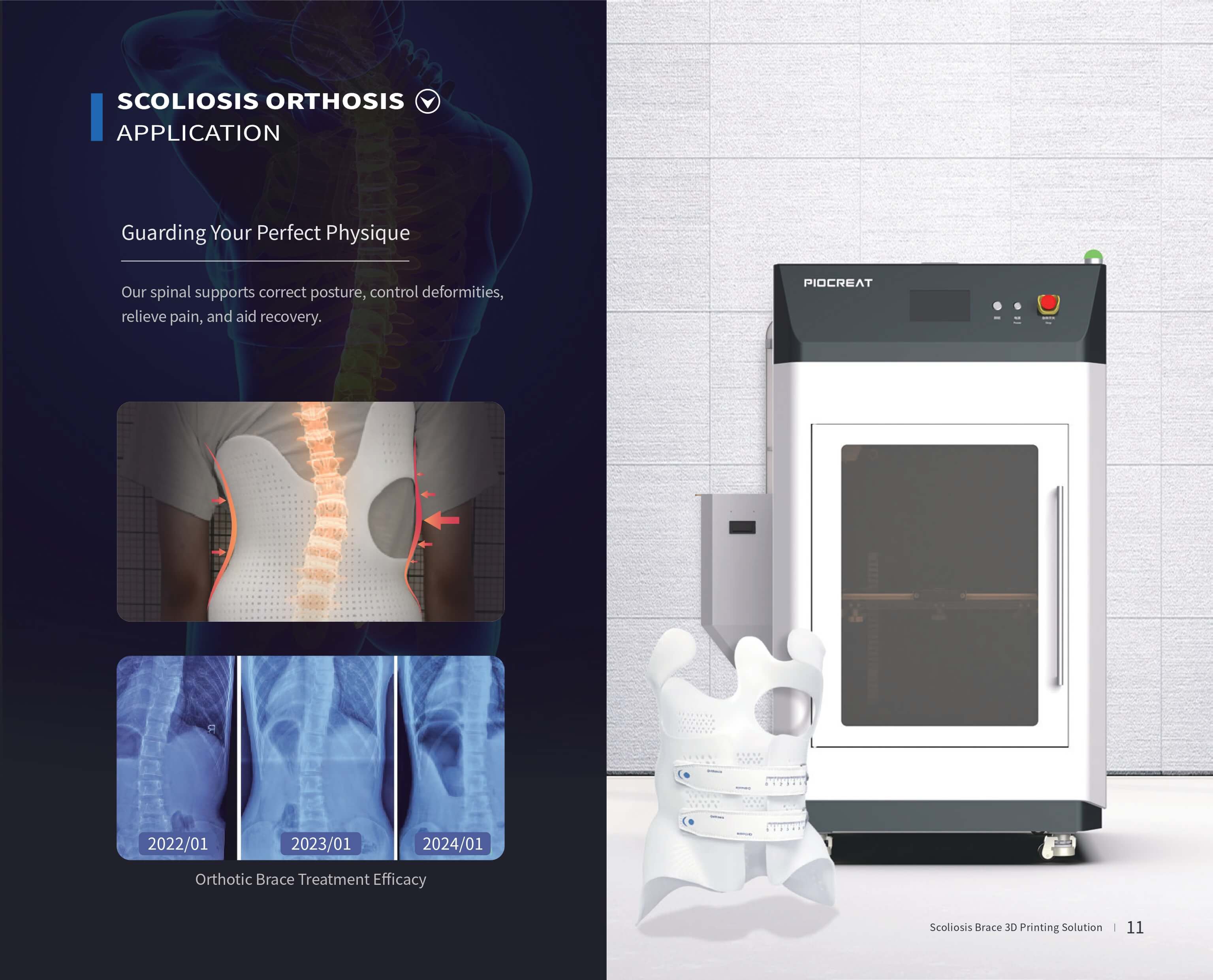 Spinal Orthotic Solutions